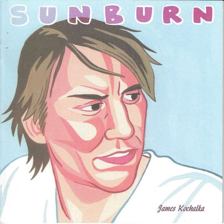 Sunburn