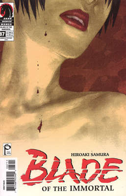 87