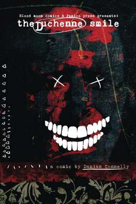 1/A
