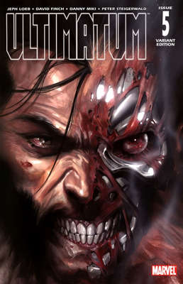 5/D