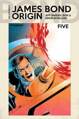 5/A